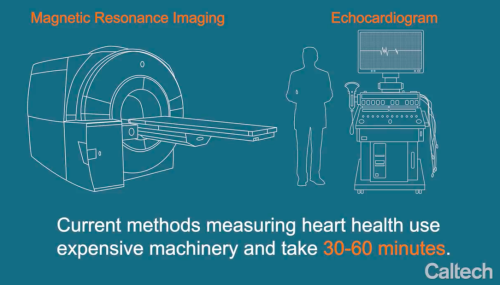 这款APP可取代超声测量法，两分钟即可诊断心脏健康